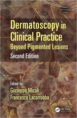 Dermatoscopy in Clinical Practice