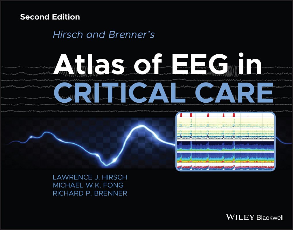 Hirsch and Brenner's Atlas of EEG in Critical Care