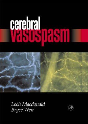 Cerebral Vasospasm