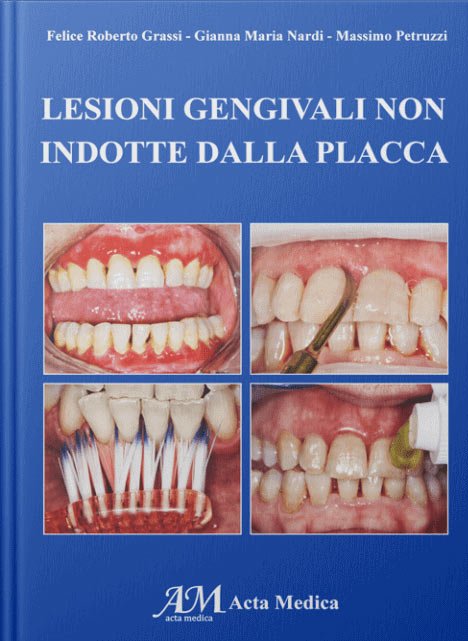 Lesioni gengivali non indotte dalla placca