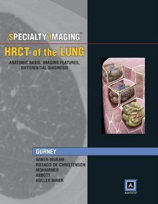 Specialty Imaging: HRCT of the Lung
