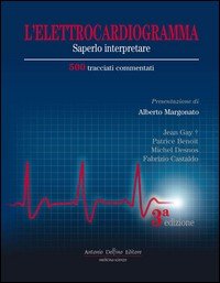Elettrocardiogramma saperlo interpretare