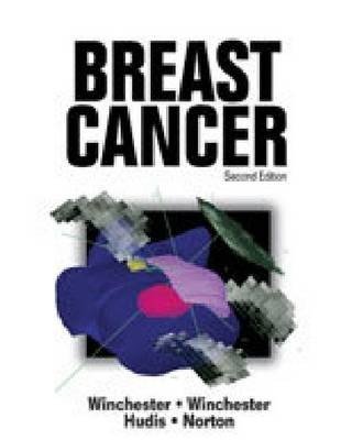 Breast Cancer