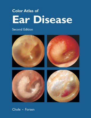 Colour Atlas of Ear Disease