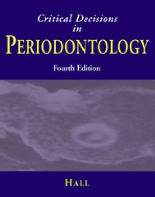 Critical Decisions in Periodontology