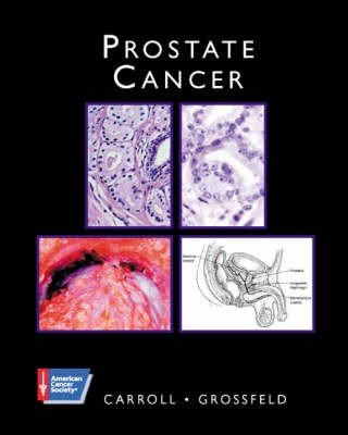 Prostate Cancer