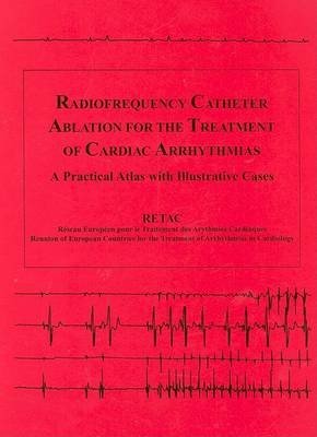 Radiofrequency Catheter Ablation