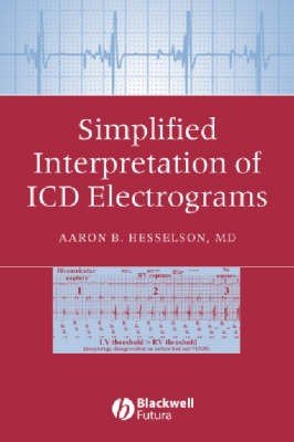 Simplified Interpretation of ICD Electrograms