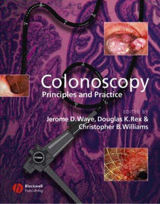 Colonoscopy
