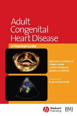 Adult Congenital Heart Disease
