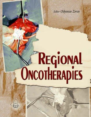 Regional Oncotherapies