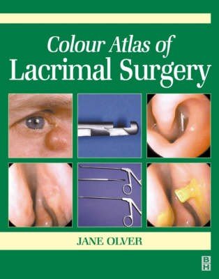 Colour Atlas of Lacrimal Surgery