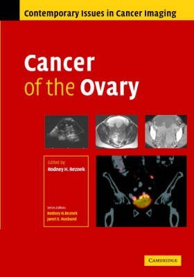 Cancer of the Ovary