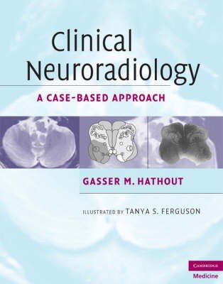 Clinical Neuroradiology