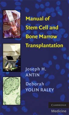 Manual of Stem Cell and Bone Marrow Transplantation