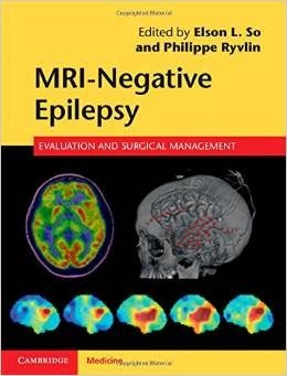 MRI - Negative Epilepsy