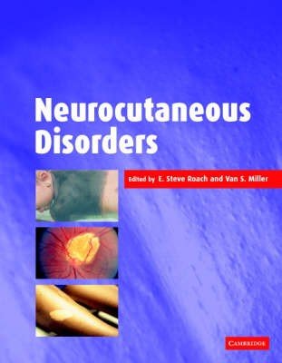 Neurocutaneous Disorders