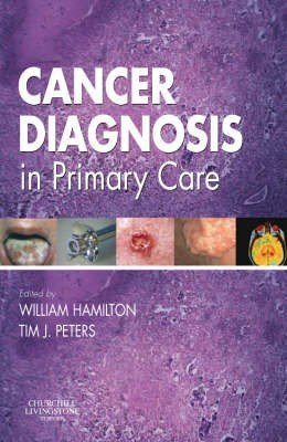 Cancer Diagnosis in Primary Care