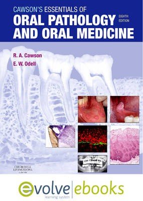 Cawson's Essentials of Oral Pathology and Oral Medicine
