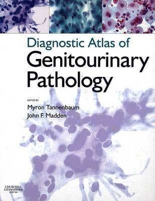Diagnostic Atlas of Genitourinary Pathology