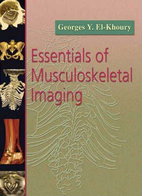 Essentials of Musculoskeletal Imaging