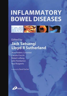 Inflammatory Bowel Diseases