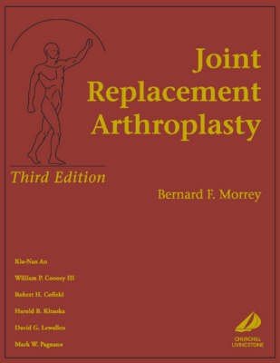 Joint Replacement Arthroplasty
