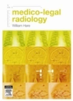 Medico-legal Radiology