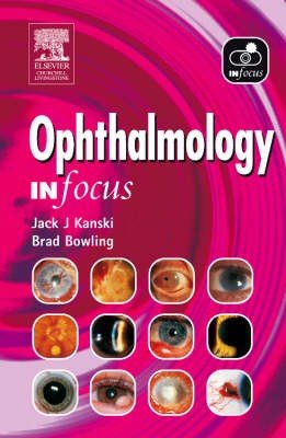 Ophthalmology in Focus