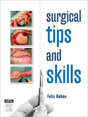 Surgical Tips and Skills