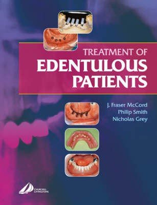 Treatment of Edentulous Patients