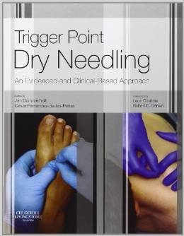 Trigger Point Dry Needling