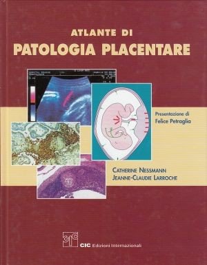 Atlante di patologia placentare