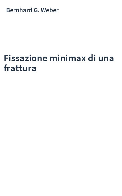 Fissazione minimax di una frattura
