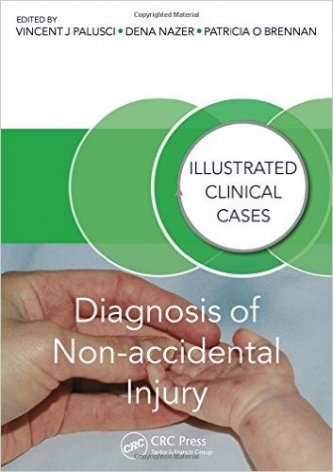 Diagnosis of Non-accidental Injury