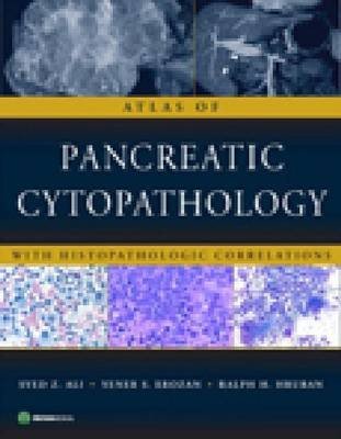 Atlas of Pancreatic Cytopathology with Histopathologic Correlations