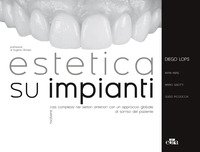 Estetica su impianti. Risolvere casi complessi nei settori anteriori con un approccio globale al sorriso del paziente
