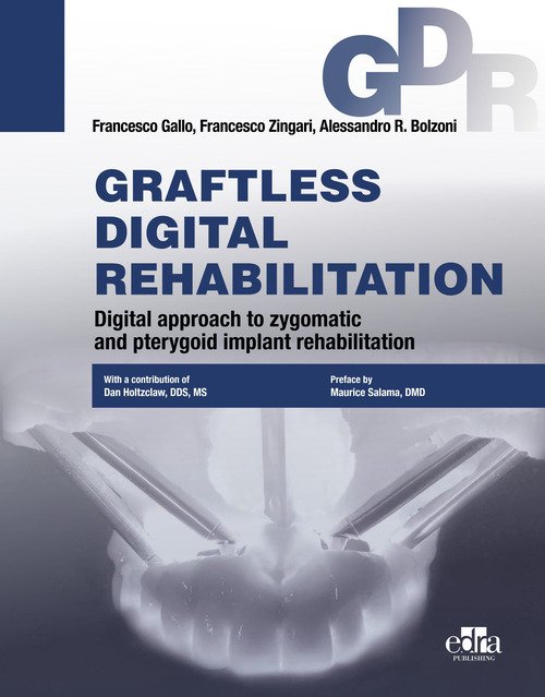 Graftless digital rehabilitation, gdr. Digital approach to zygomatic and pterygoid implant rehabilitation EDIZIONE IN INGLESE