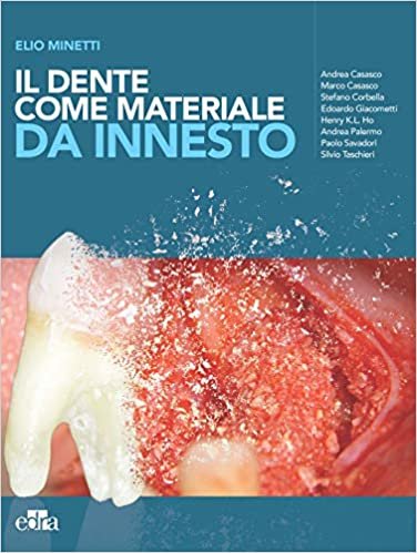 Il dente come materiale da innesto