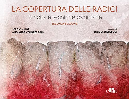 La copertura delle radici. Principi e tecniche avanzate