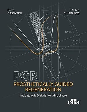 PGR. Prosthetically guided regeneration. Implantologia Digitale Multidisciplinare