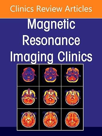 MR Imaging of Head and Neck Cancer, An Issue of Magnetic Resonance Imaging Clinics of North America
