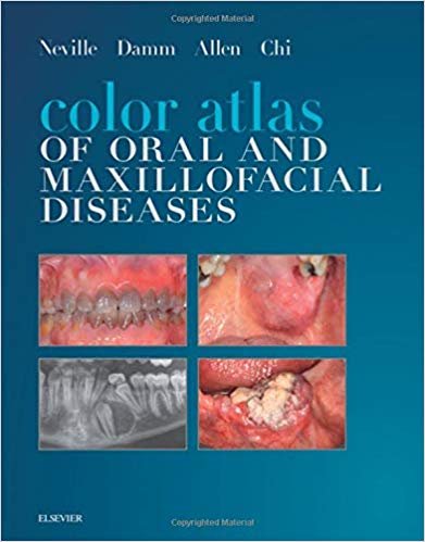 Color Atlas of Oral and Maxillofacial Diseases
