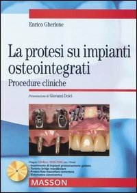 La protesi su impianti osteointegrati. Procedure cliniche. Con CD-ROM