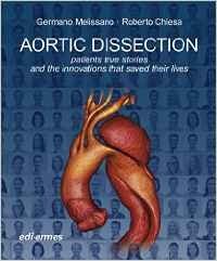 Aortic Dissection