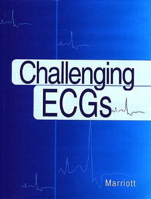 Challenging ECGs