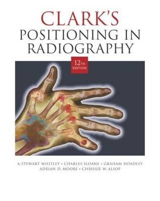 Clark's Positioning in Radiography