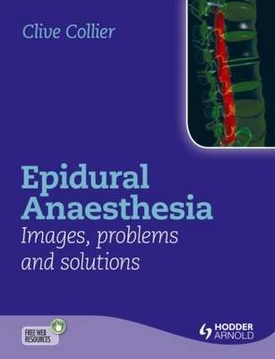 Epidural Anaesthesia Images, Problems and Solutions