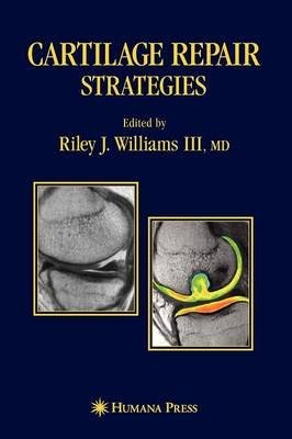 Cartilage Repair Strategies