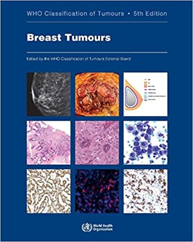 Who Classification of Tumors: Breast Tumours